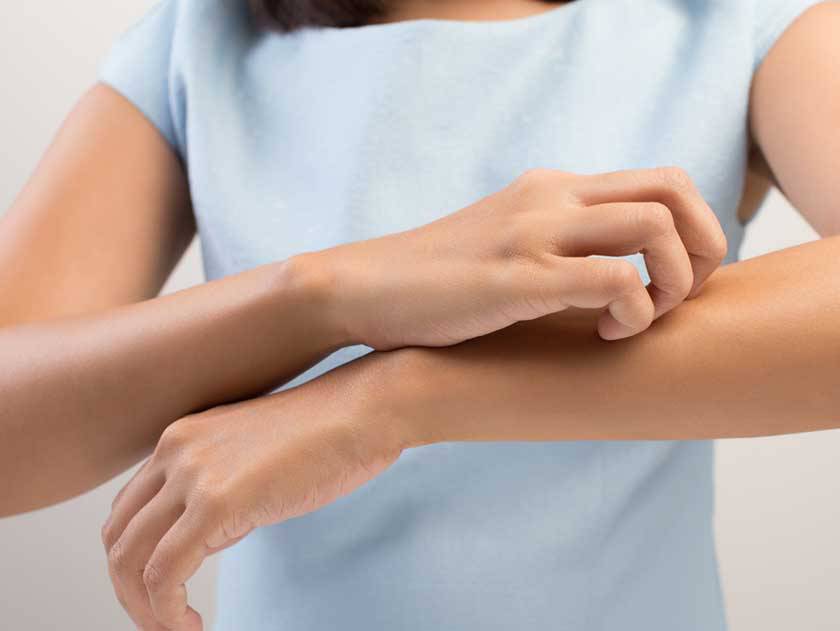 2 cases of West Nile Fever reported in East Texas 2 cases of West Nile Fever reported in East Texas