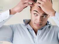 What Is the Best Treatment for Hair Loss? Get Answers To Your FAQs