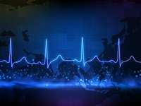 What Is Cardiac Arrest?