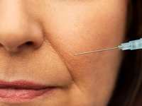 Don't Frown Over Smile Lines: Let us Help You Banish Them