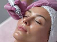 Why You Should Add Microneedling to Your Wellness Routine