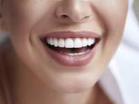 Is It Safe to Whiten My Teen’s Teeth?