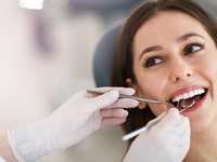 What to Expect During a Dental Checkup