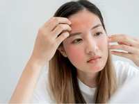 Signs Your Skin Is Reacting to New Products