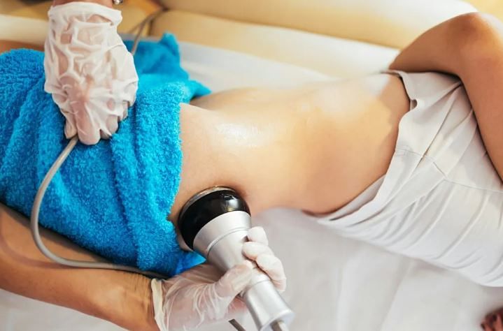 Non-Surgical Lipo in The Woodlands: Who’s a Good Candidate?