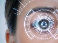 What is Iridology?