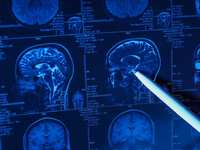 How can a traumatic brain injury affect your daily life?