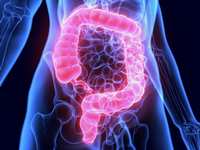 Colorectal Cancer: Signs, Symptoms and Screenings