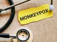 Is Monkeypox Next?