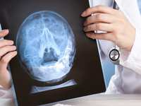 Chronic Sinus Problems?