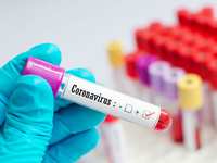 COVID-19 Antibody Testing COVID-19 Antibody Testing