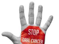 The Role of Oral Surgeons in Oral Cancer Screenings