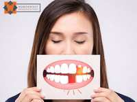 Can Missing Teeth Affect Your Overall Health?