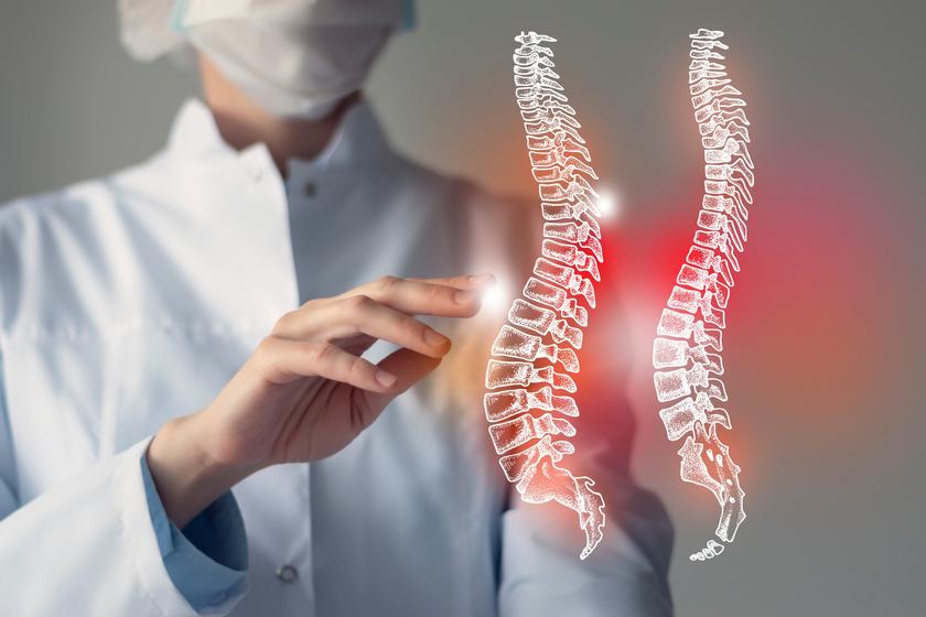 How Chiropractic Helps Patients with Scoliosis