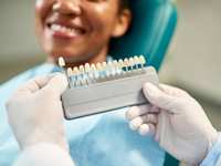 How Veneer Shade Selection Creates a Natural-Looking Smile in The Woodlands, TX