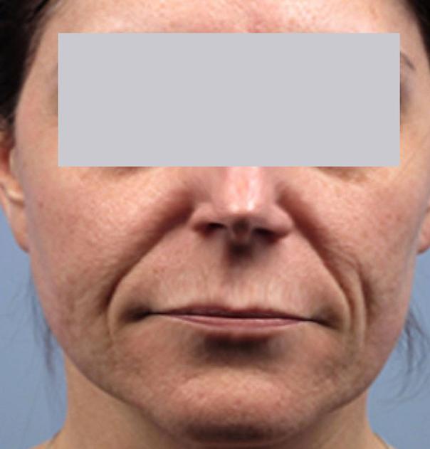 Elite Medical Skin & Laser Center by Gallery Photos The Woodlands Tx