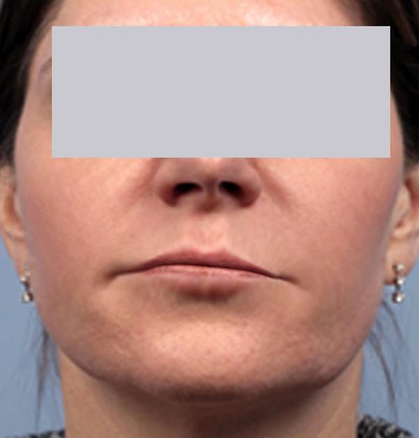 Elite Medical Skin & Laser Center by Gallery Photos The Woodlands Tx