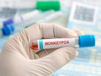 Montgomery County Confirms 2nd Probable Case Of Monkeypox